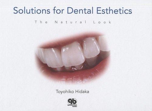 Solutions for Dental Esthetics