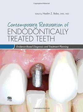 Contemporary Restoration of Endodontically Treated Teeth