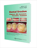 Dental Erosion