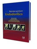 Reintervention in Endodontics