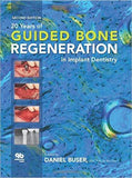 20 Years of Guided Bone Regeneration in Implant Dentistry