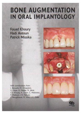 Bone Augmentation in Oral Implantology