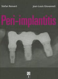 Peri-implantitis