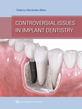 Controversial Issues in Implant Dentistry
