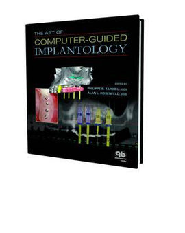 The Art of Computer-Guided Implantology