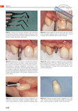 Praktična implantologija