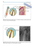 Priručnik iz endodoncije za praktičara