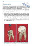 Priručnik iz endodoncije za praktičara