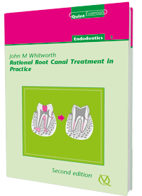 Rational Root Canal Treatment in Practice