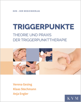 Triggerpunkte
