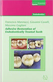 Adhesive Restoration of Endodontically Treated Teeth