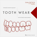 Tooth Wear - Interceptive treatment approach with minimally invasive protocols