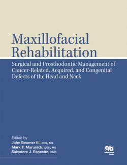 Maxillofacial Rehabilitation