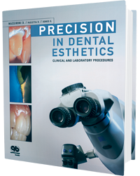 Precision in Dental Esthetics