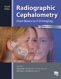 Radiographic Cephalometry From Basics to 3-D Imaging