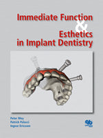 Immediate Function & Esthetics in Implant Dentistry