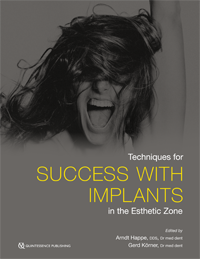 Techniques for Success with Implants in the Esthetic Zone