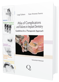 Atlas of Complications and Failures in Implant Dentistry