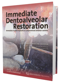 Immediate Dentoalveolar Restoration