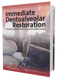 Immediate Dentoalveolar Restoration