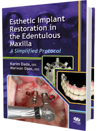 Esthetic Implant Restoration in the Edentulous Maxilla