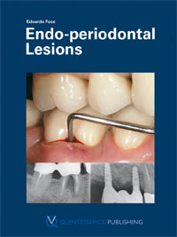 Endo-periodontal Lesions
