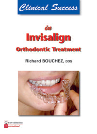 Clinical Success in Invisalign Orthodont Treatment