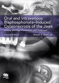 Oral and Intravenous Bisphosphonate-Induced Osteonecrosis of the Jaws