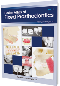 Color Atlas of Fixed Prosthodontics Vol. 2