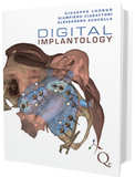 Digital Implantology