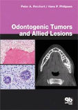 Odontogenic Tumors and Allied Lesions