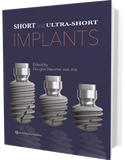 Short and Ultra-Short Implants