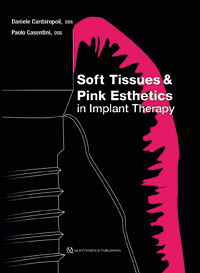 Soft Tissues and Pink Esthetics in Implant Therapy