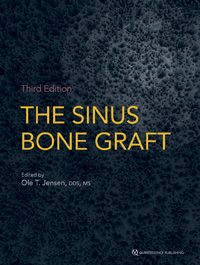 The Sinus Bone Graft