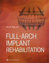 Full-Arch Implant Rehabilitation