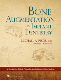 Bone Augmentation in Implant Dentistry