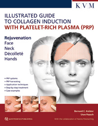 Illustrated Guide to Collagen Induction with Platelet-Rich Plasma (PRP) KVM