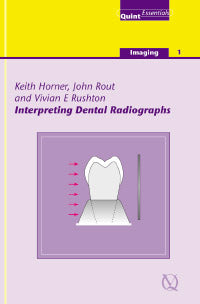 Interpreting Dental Radiographs