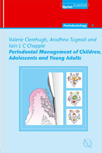 Periodontal Management of Children, Adolescents and Young Adults