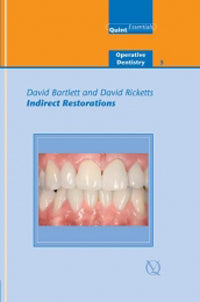 Indirect Restorations