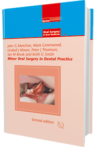 Minor Oral Surgery in Dental Practice