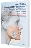 Fractured Instrument Removal A Systematic Approach