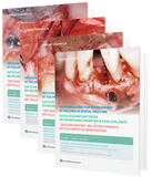 Decision making for retreatment of failures in dental medicine - DVD Compendium