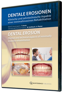 Dental Erosion