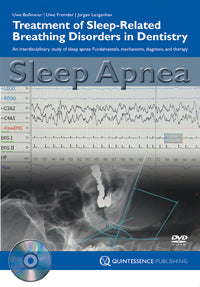 Sleep Apnea Treatment of Sleep-Related Breathing Disorders in Dentistry