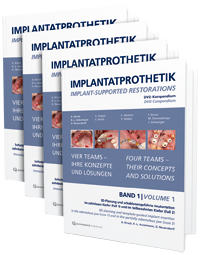 DVD-Kompendium Implantatprothetik / Implant-supported restorations Vier Teams - Ihre Konzepte und Lösungen / Four teams - their concepts and solutions
