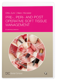Pre-, Peri- and Post-Operative Soft Tissue Management