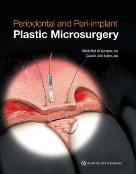 Periodontal and Peri‑implant Plastic Microsurgery