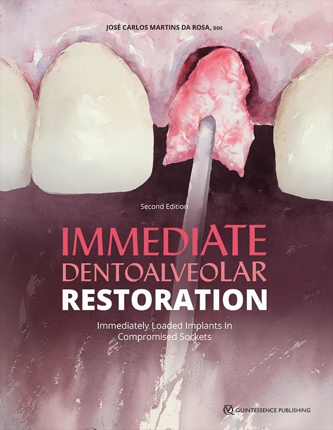 Immediate Dentoalveolar Restoration